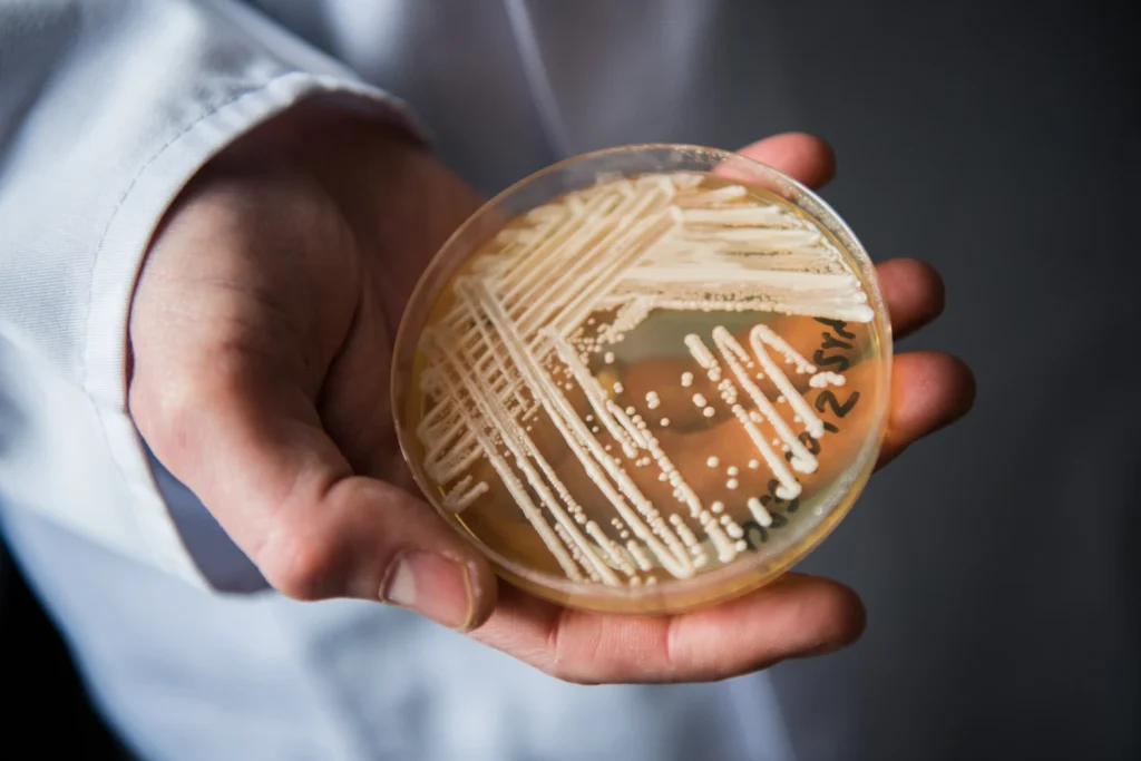 Deadly Fungus on the Rise, Study Cautions